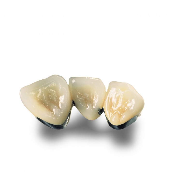 4 All Κράμα Νικελίου – Χρωμίου