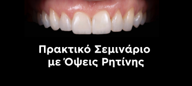 Όψεις Ρητίνης